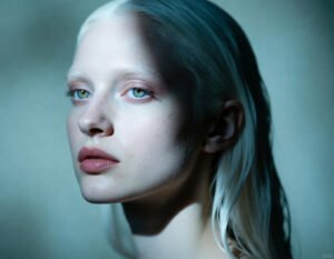Albino Model in Teal Wall Portrait
